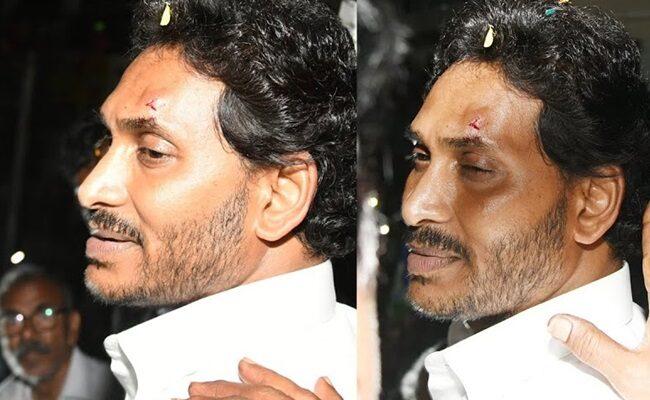 Jagan Injured In Stone Attack: What did KTR, Sharmila, Modi say?