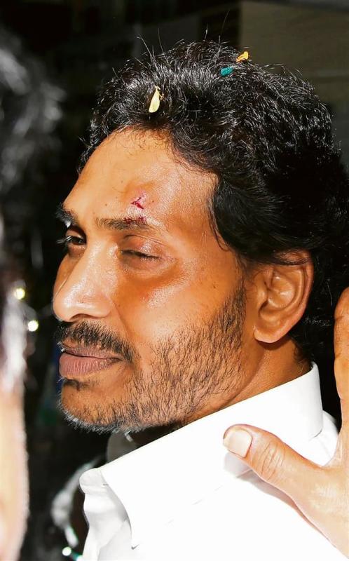AP CM Jagan Mohan Reddy Injured In Shocking Stone Pelting