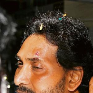 AP CM Jagan Mohan Reddy Injured In Shocking Stone Pelting