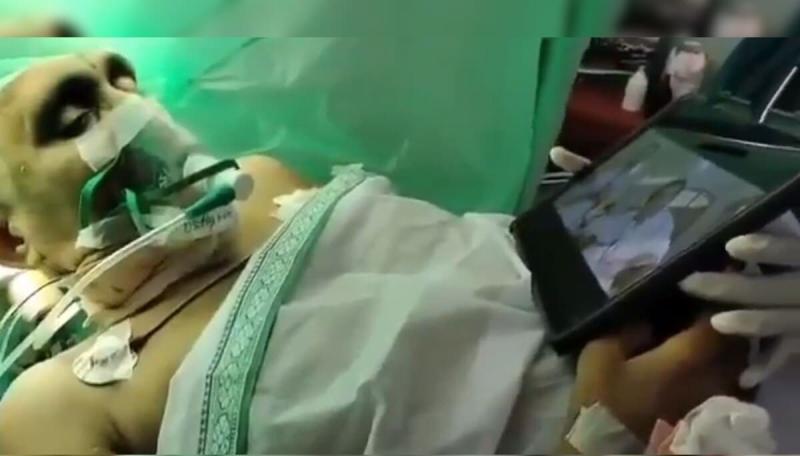 Awake Craniotomy in Andhra Pradesh: Patient Watches Jr. NTR Film During Brain Surgery