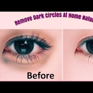 Effective Desi Home Remedies for Dark Circles: Natural Solutions for Brighter Eyes